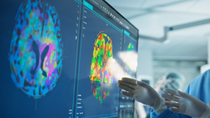 Monitor, an dem markierte Hirnregionen betrachtet werden